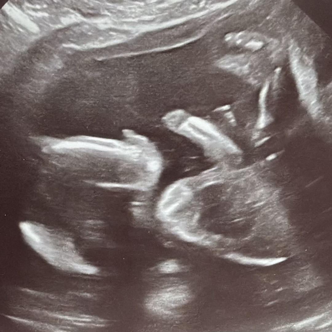 Photo shared by Amanda for their Babylist baby registry.