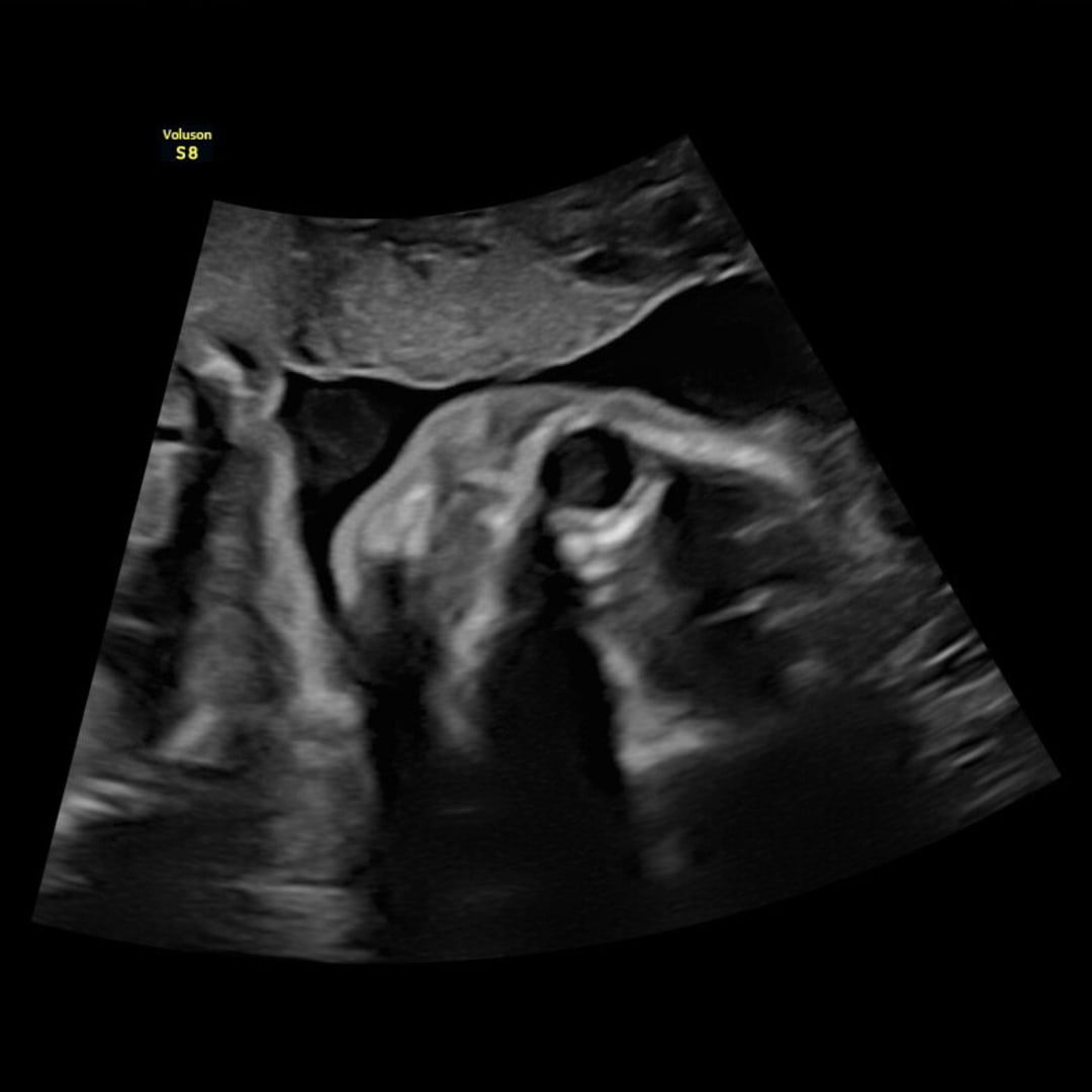 Photo shared by Ashley for their Babylist baby registry.