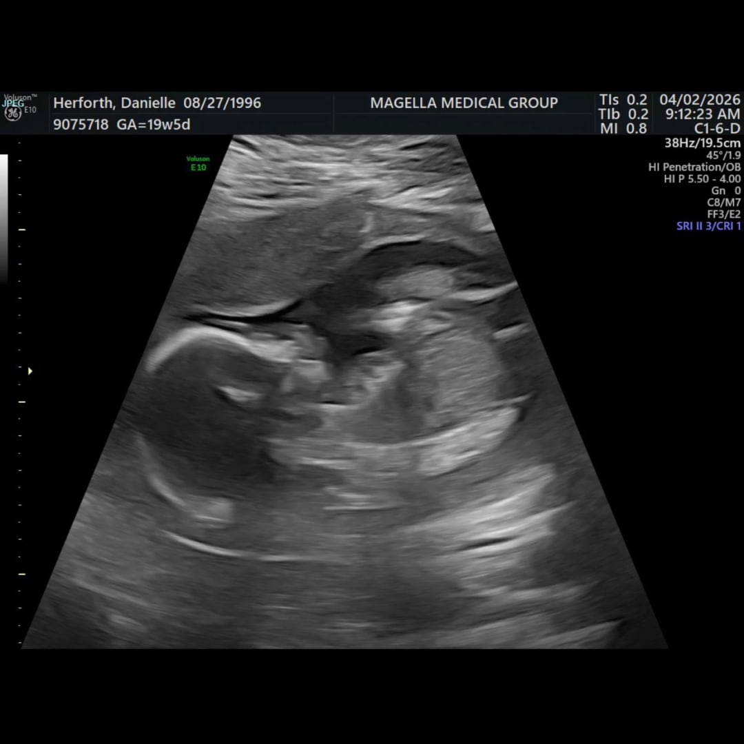 Photo shared by Danielle for their Babylist baby registry.