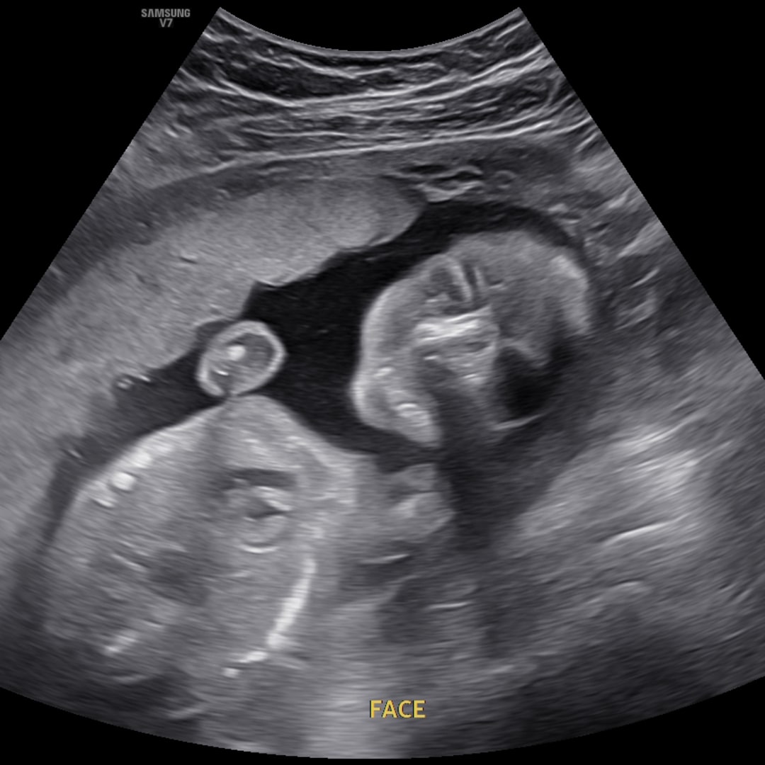 Photo shared by Catherine for their Babylist baby registry.