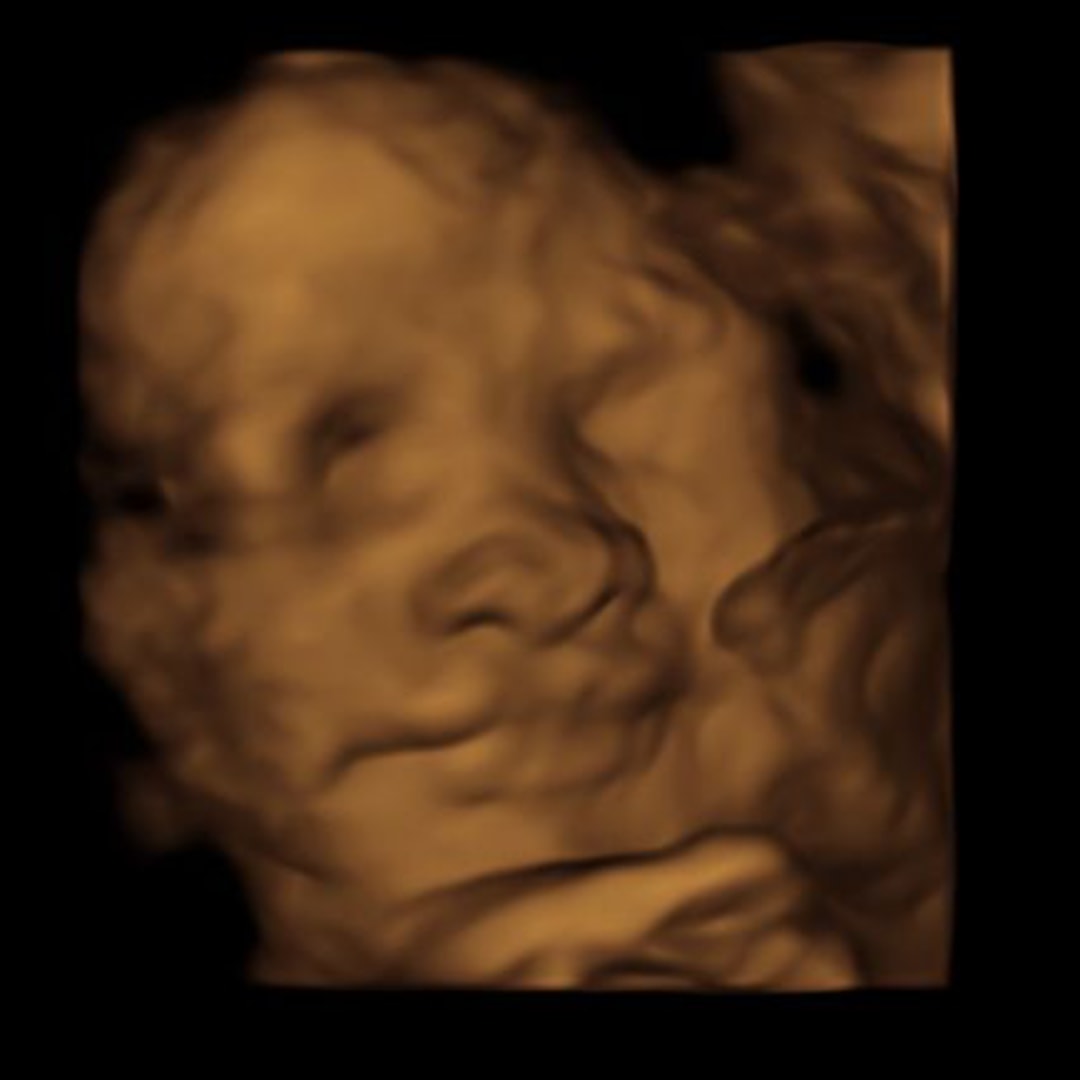 Photo shared by Janet for their Babylist baby registry.