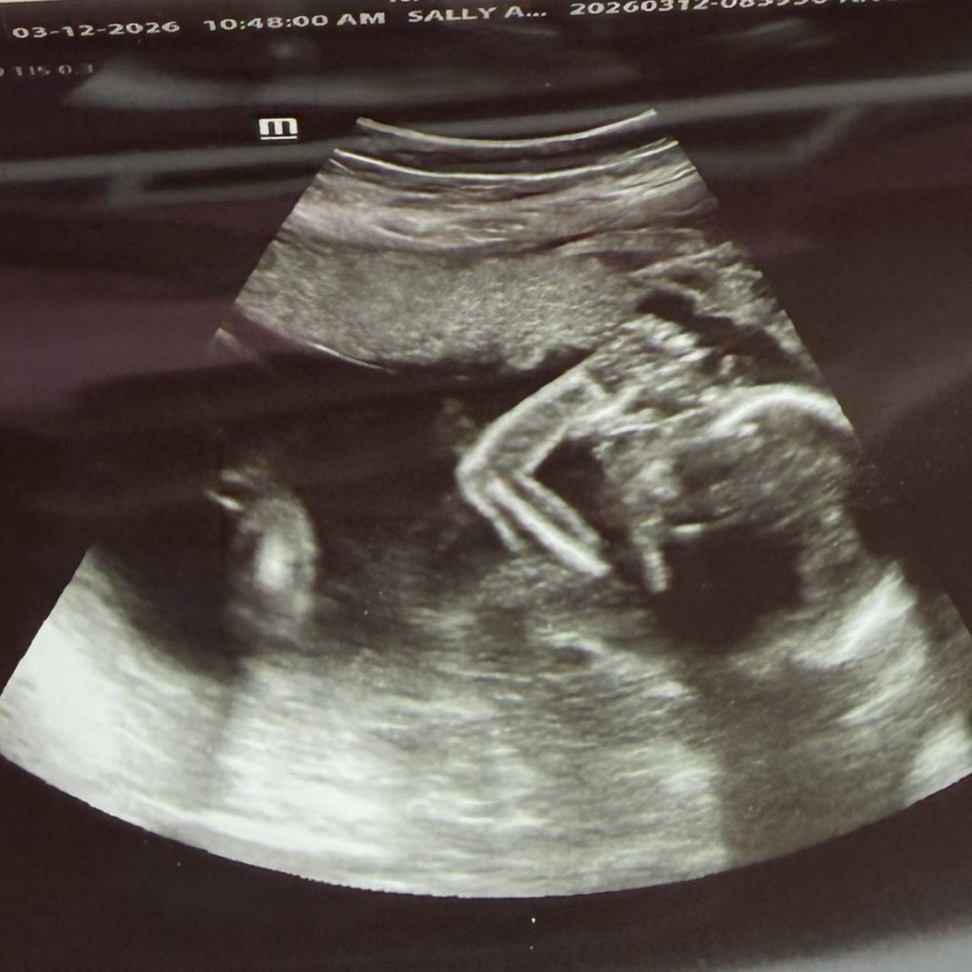 Photo shared by Lexi for their Babylist baby registry.