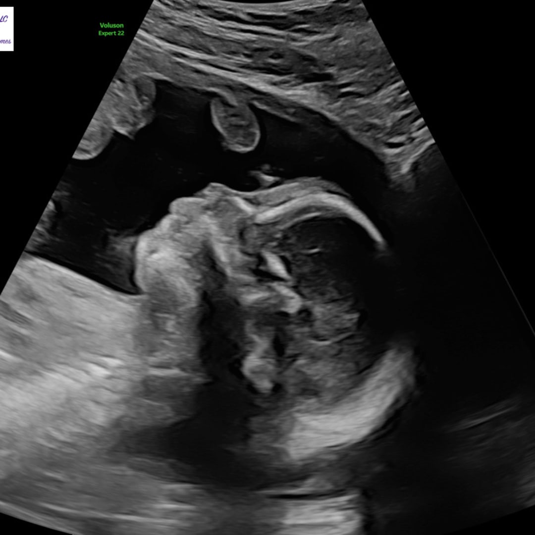 Photo shared by Dustin for their Babylist baby registry.