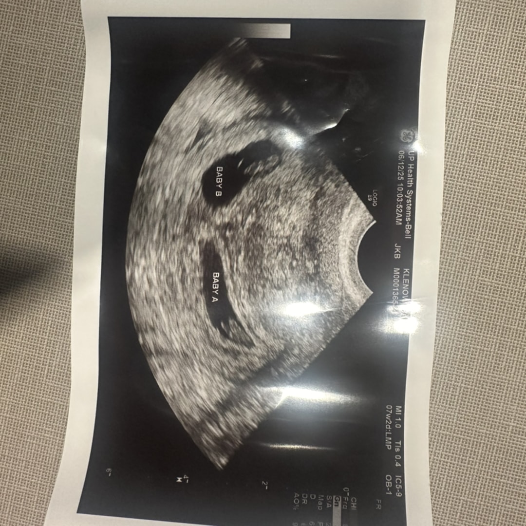 Photo shared by Sarah for their Babylist baby registry.