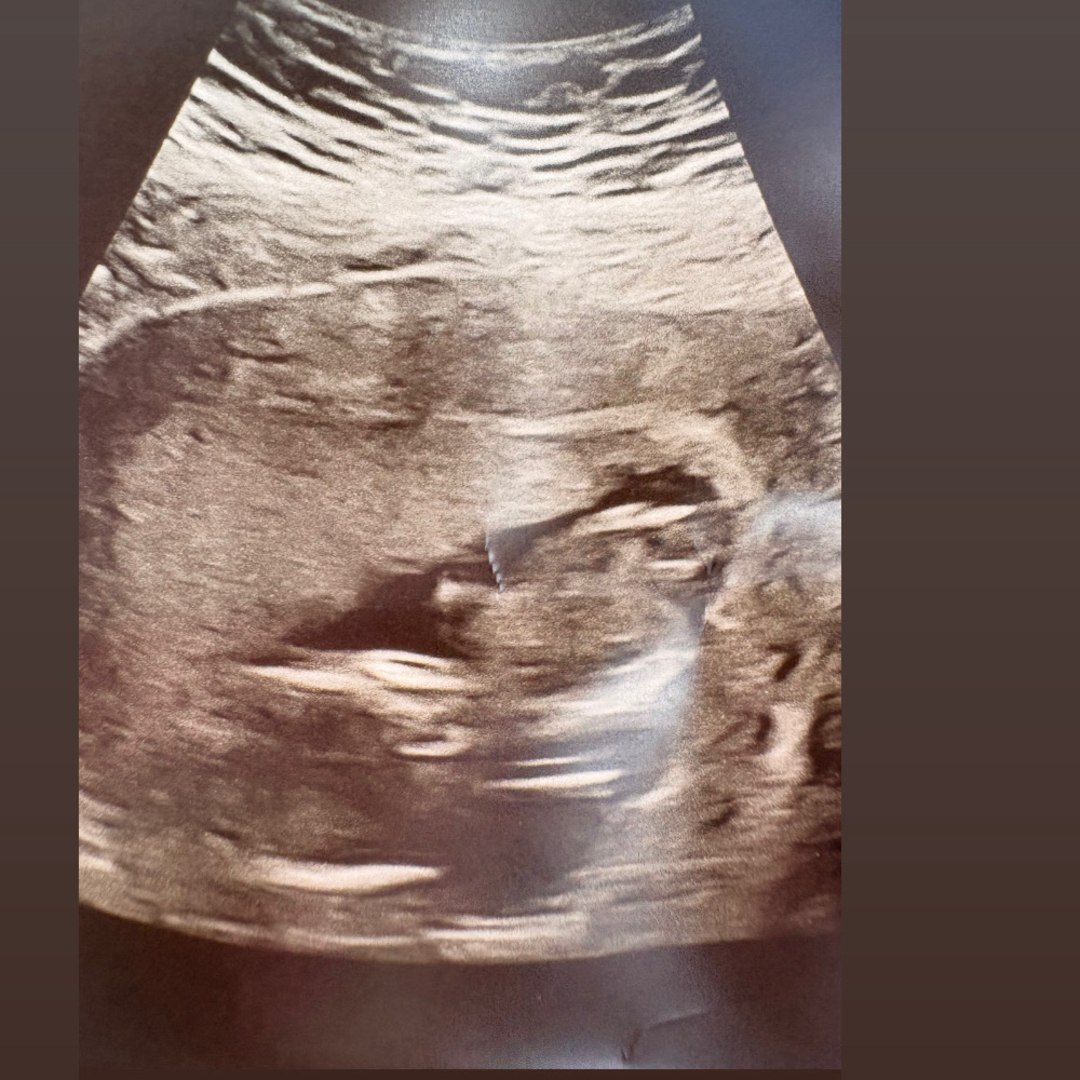 Photo shared by Tatyana for their Babylist baby registry.