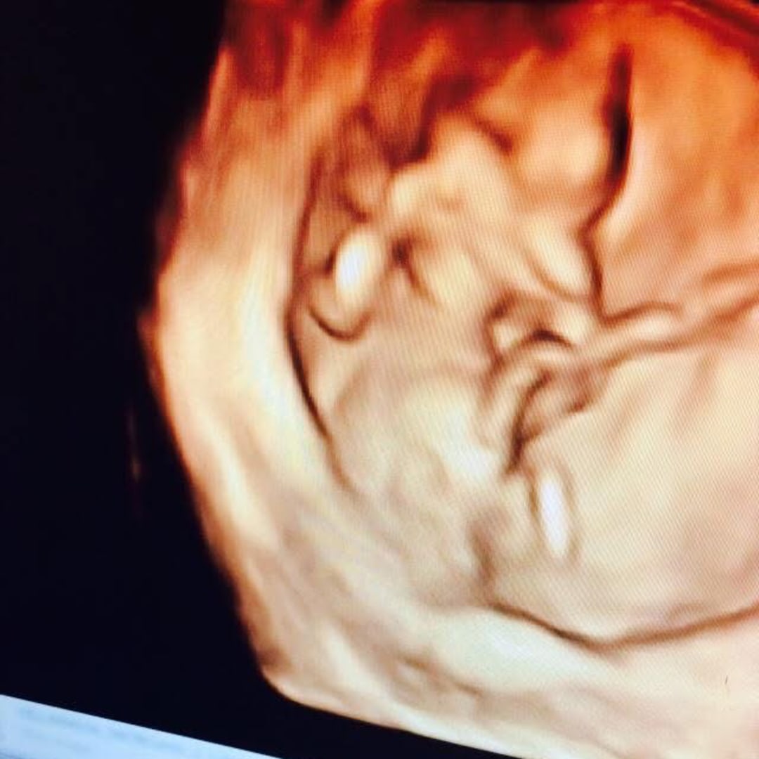 Photo shared by Morgan for their Babylist baby registry.