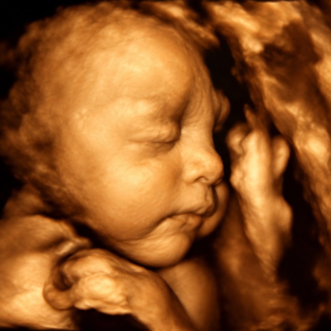 Photo shared by Hunter for their Babylist baby registry.