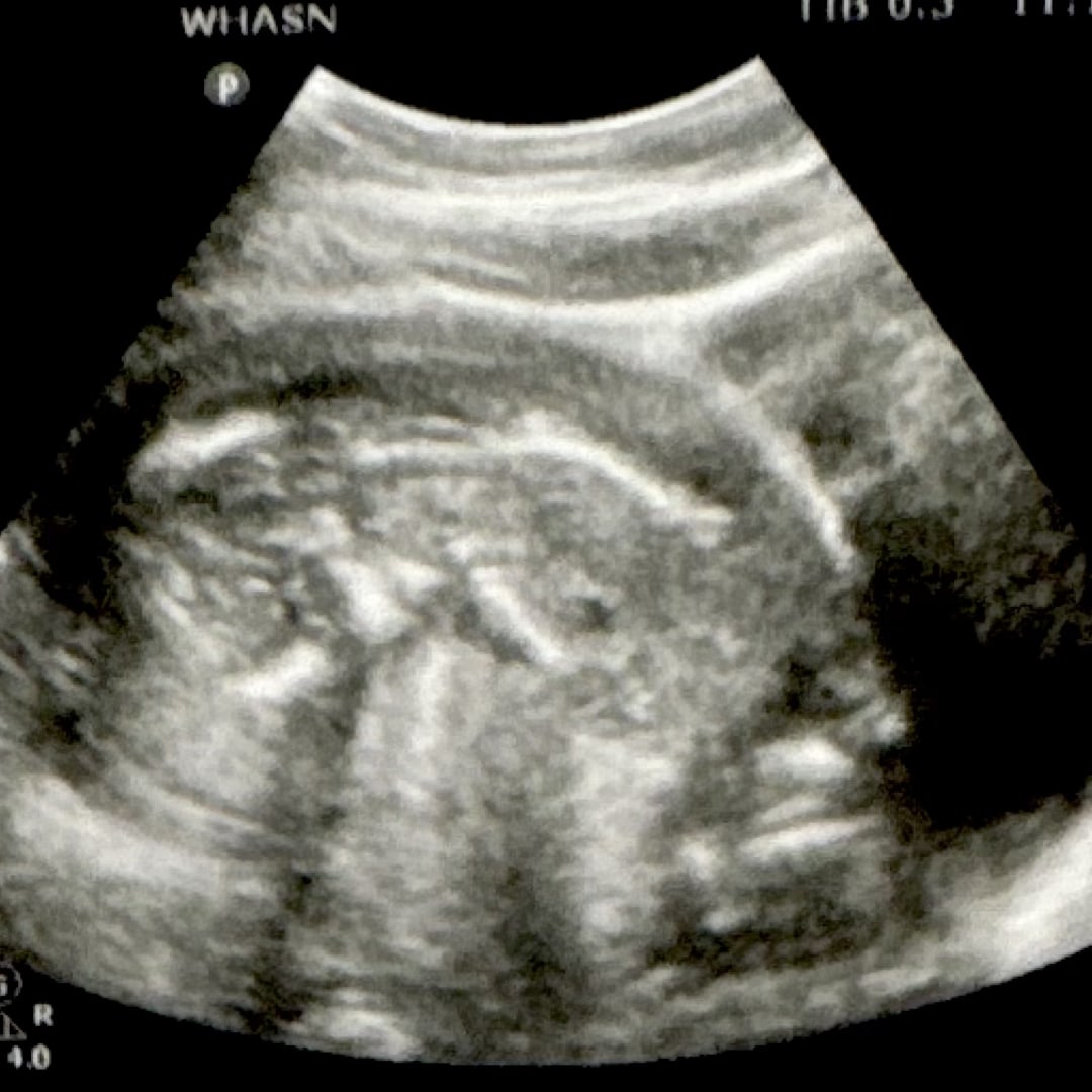 Photo shared by Brianna for their Babylist baby registry.