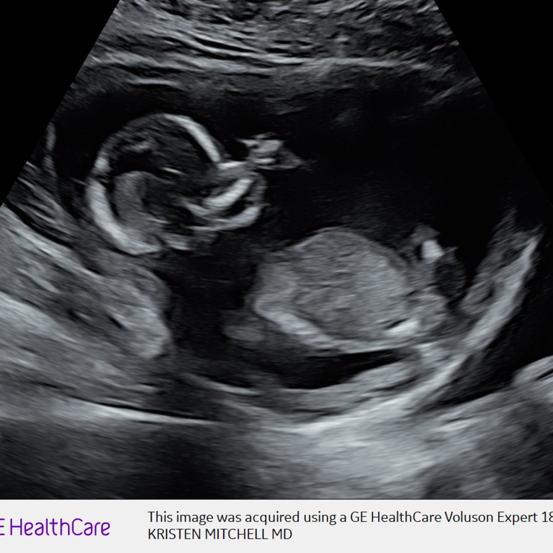 Photo shared by Hannah for their Babylist baby registry.
