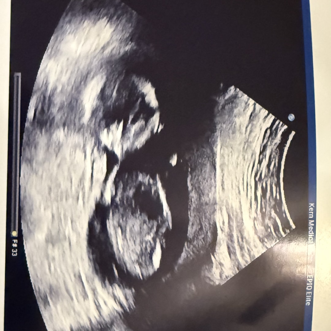 Photo shared by Lindsey for their Babylist baby registry.