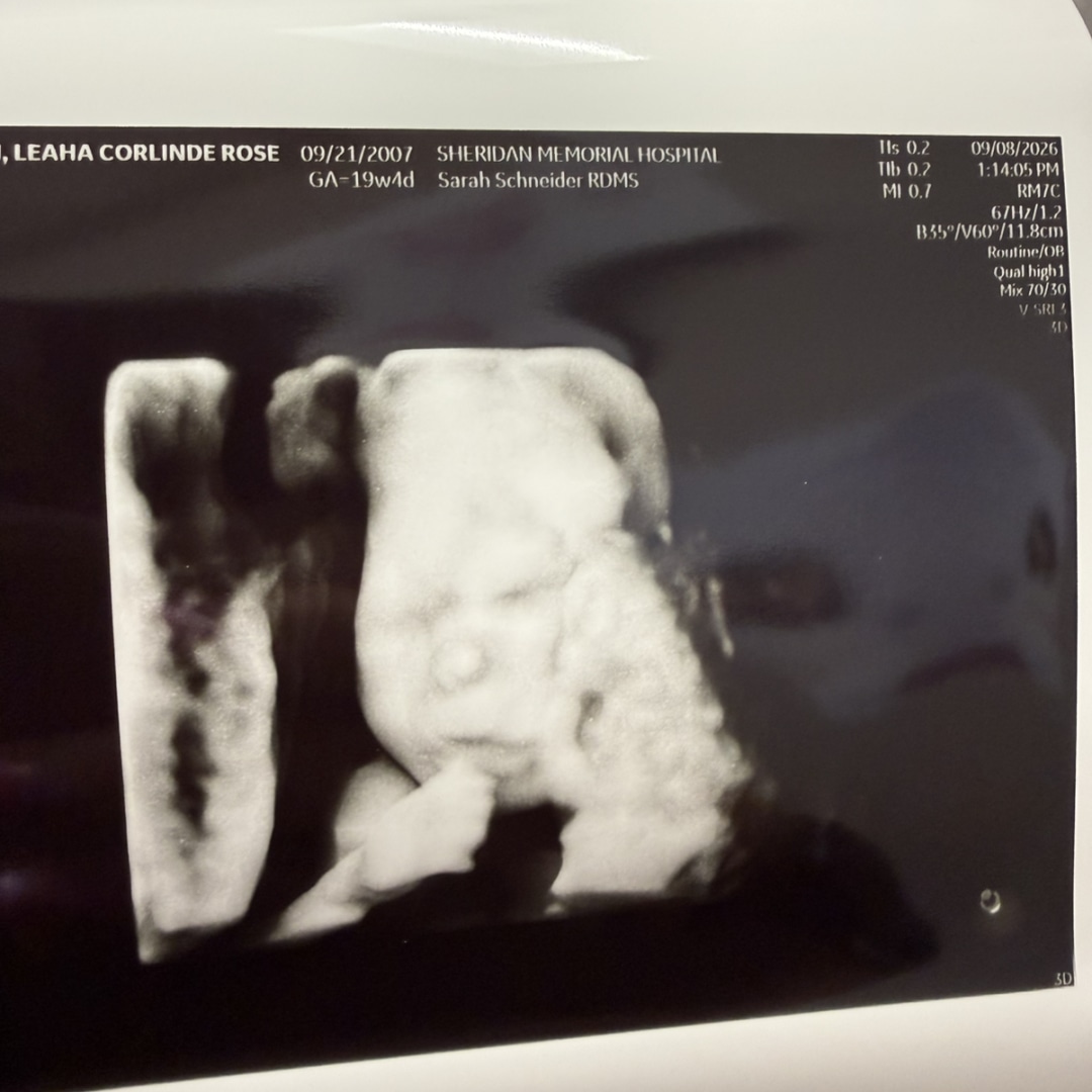 Photo shared by Leaha for their Babylist baby registry.