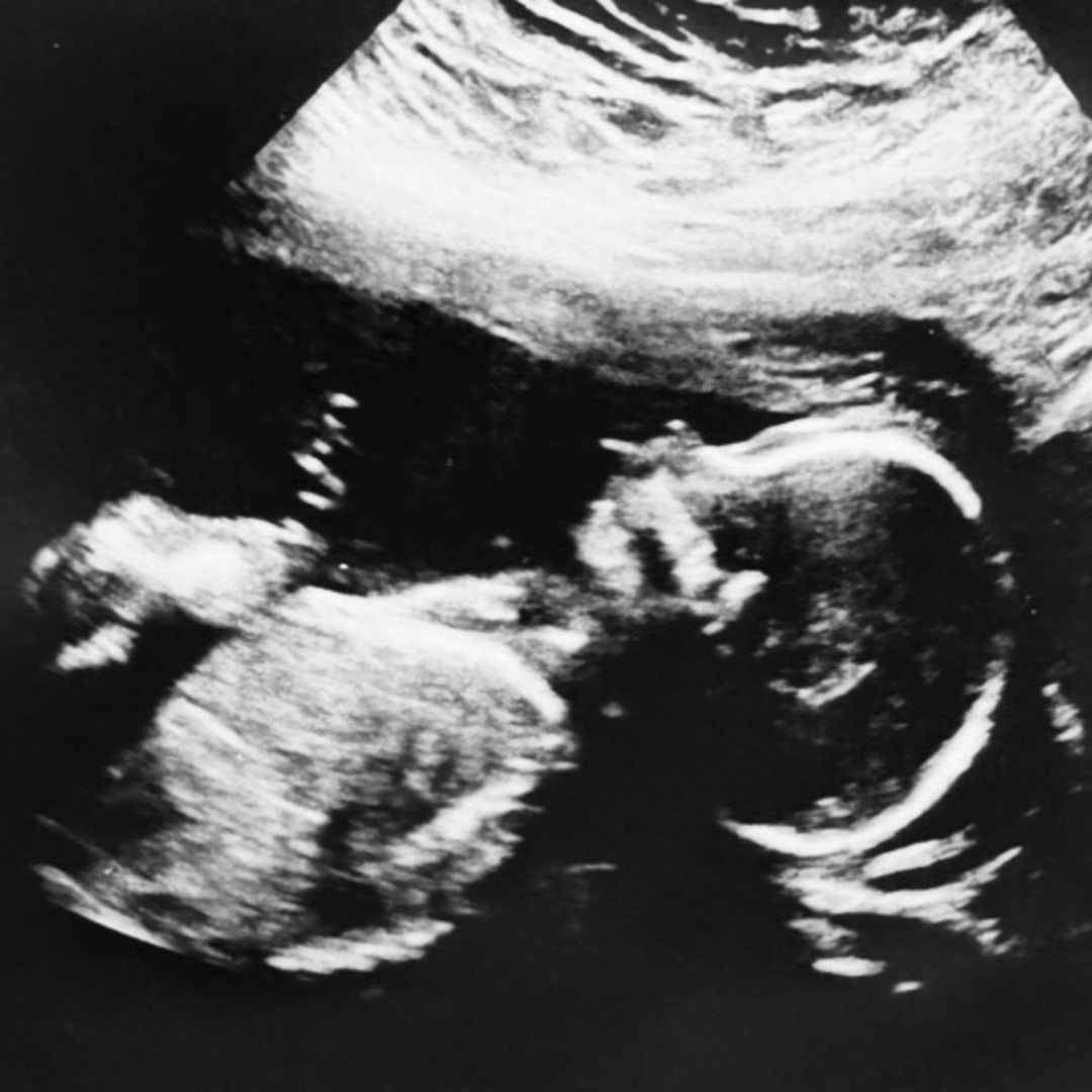 Photo shared by Ashlyn for their Babylist baby registry.