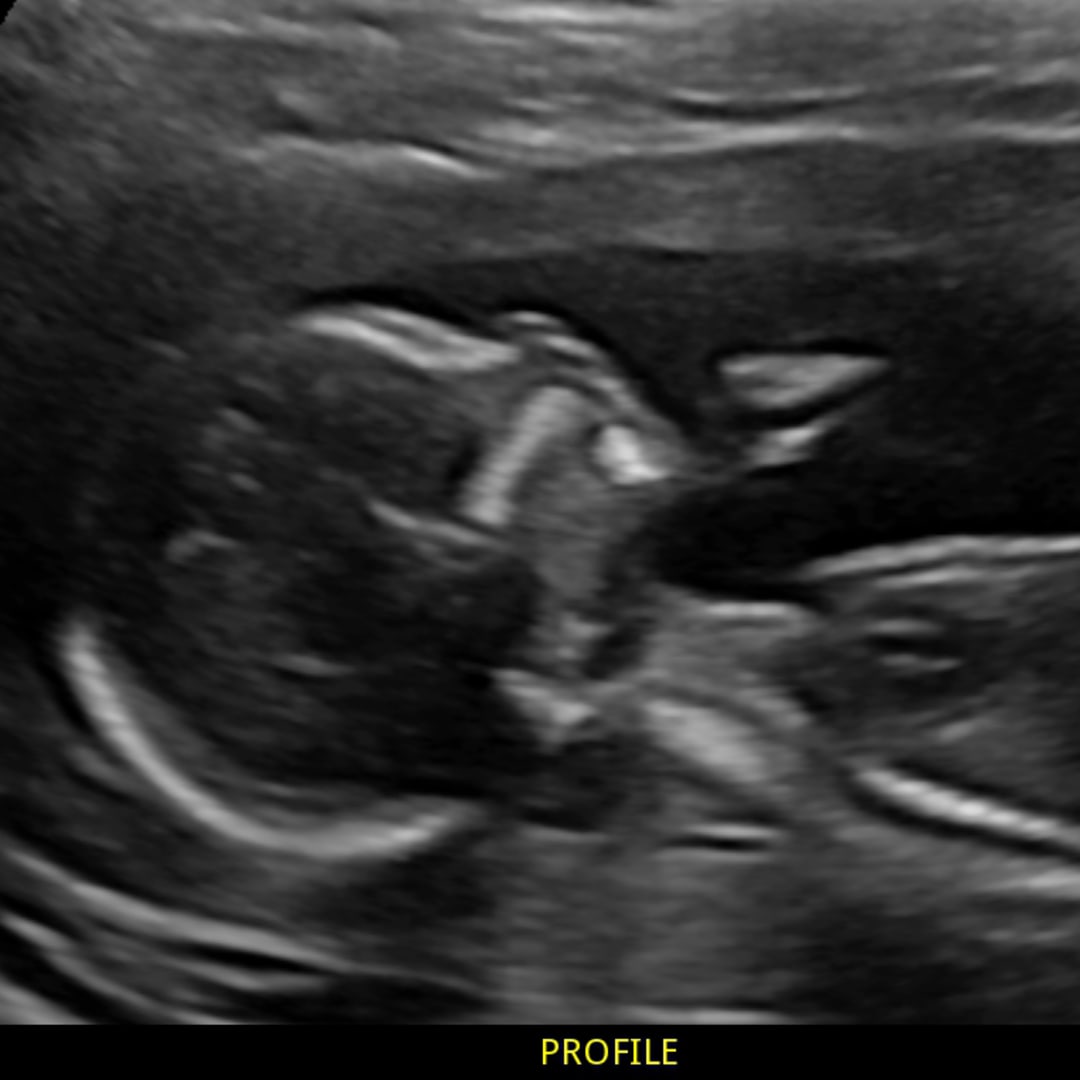 Photo shared by Katie for their Babylist baby registry.