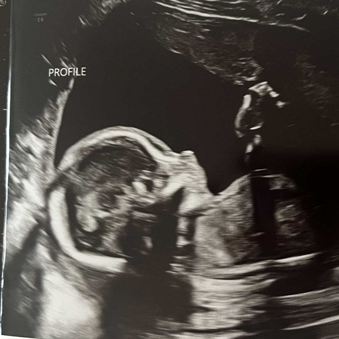 Photo shared by Kambria for their Babylist baby registry.