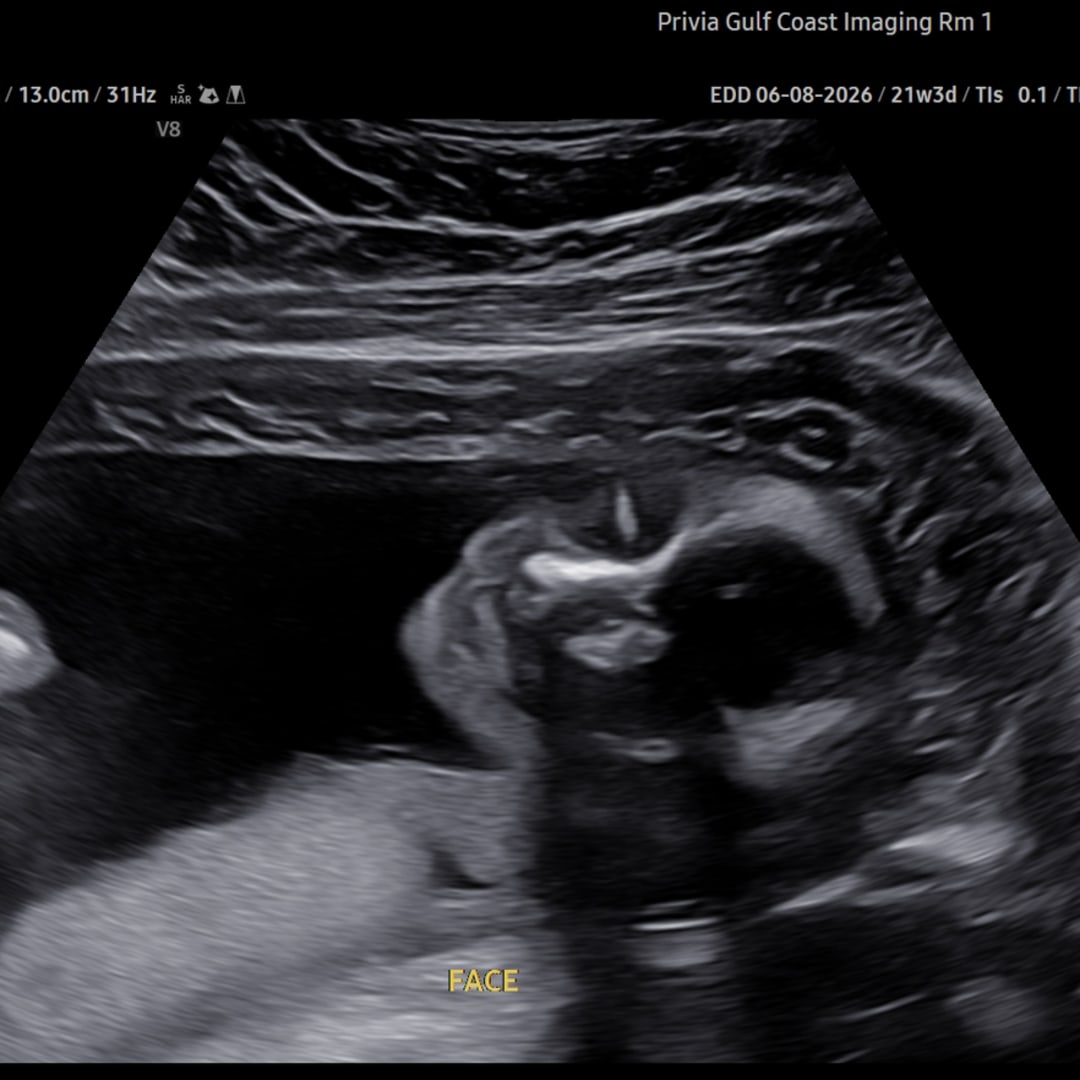 Photo shared by Lauren for their Babylist baby registry.