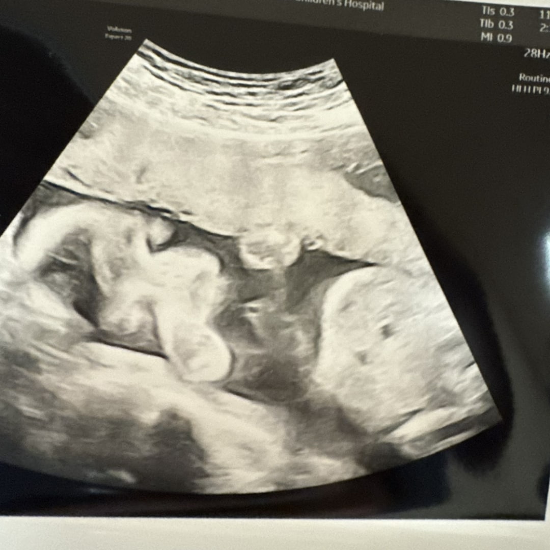 Photo shared by Morgan for their Babylist baby registry.