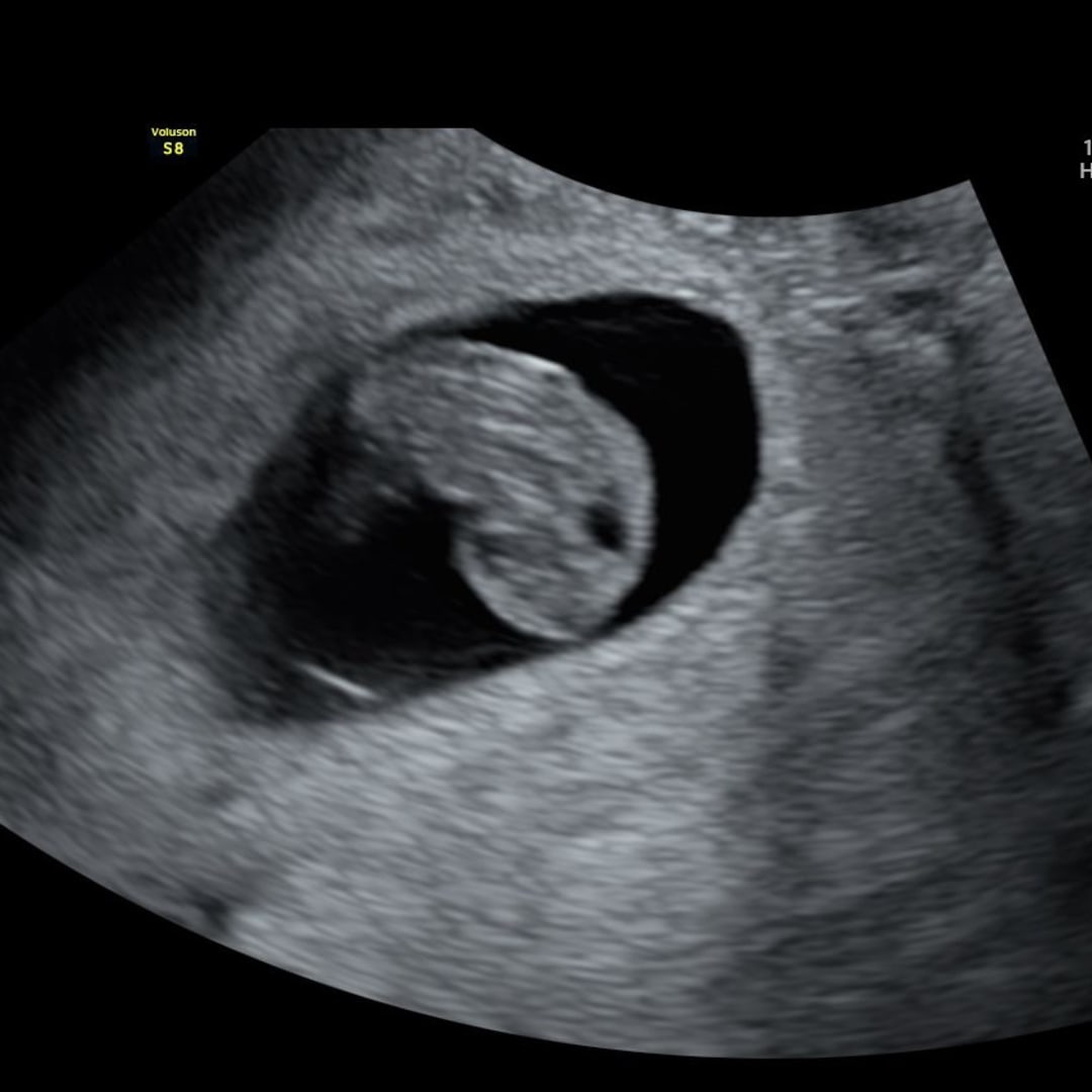 Photo shared by Andrea for their Babylist baby registry.