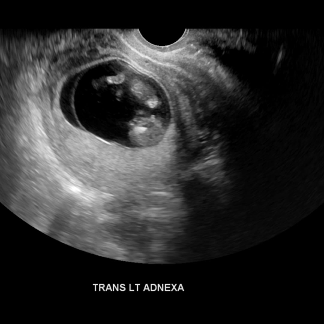 Photo shared by Lynn for their Babylist baby registry.