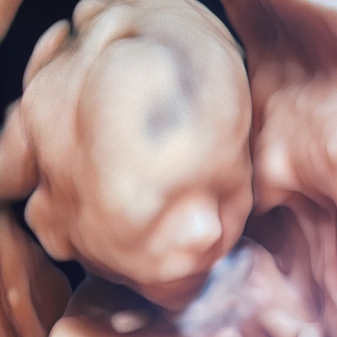 Photo shared by Olivia for their Babylist baby registry.