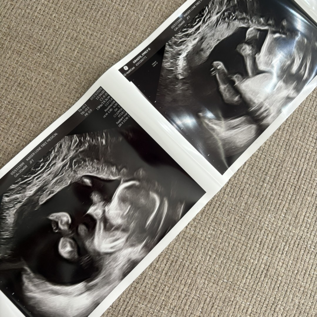 Photo shared by Emily for their Babylist baby registry.