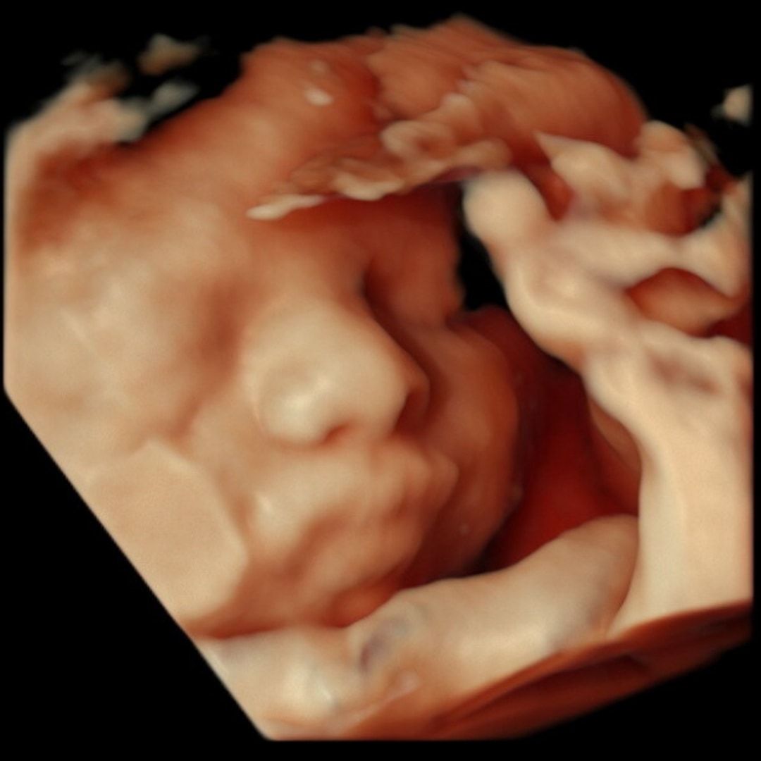 Photo shared by Elizabeth for their Babylist baby registry.