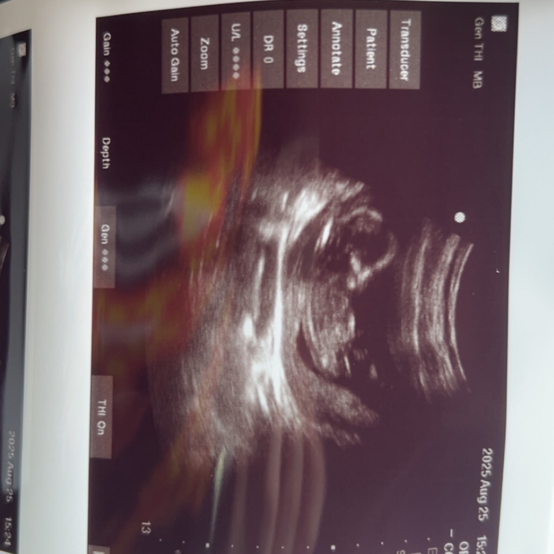 Photo shared by Whitney for their Babylist baby registry.