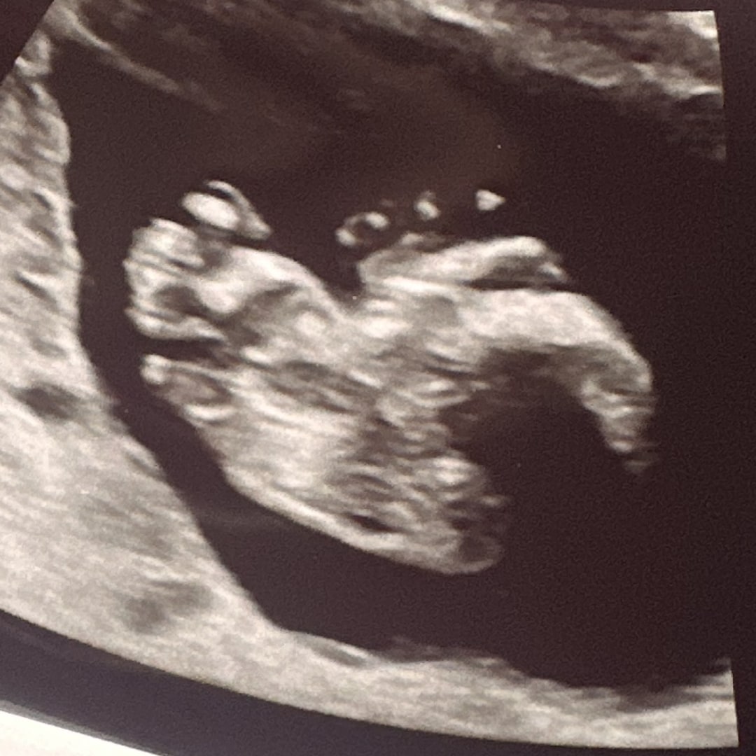 Photo shared by Katie for their Babylist baby registry.