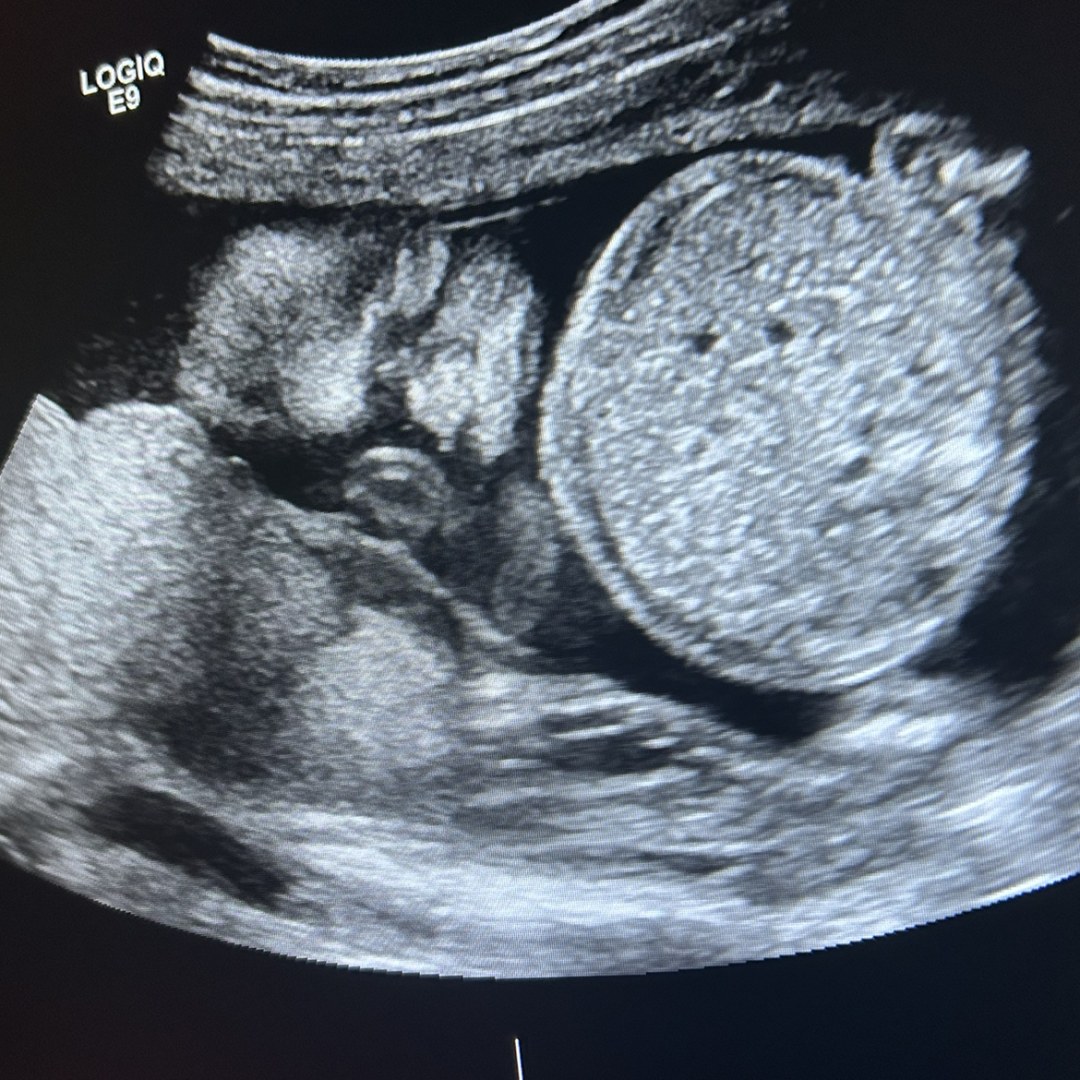 Photo shared by Leeann for their Babylist baby registry.