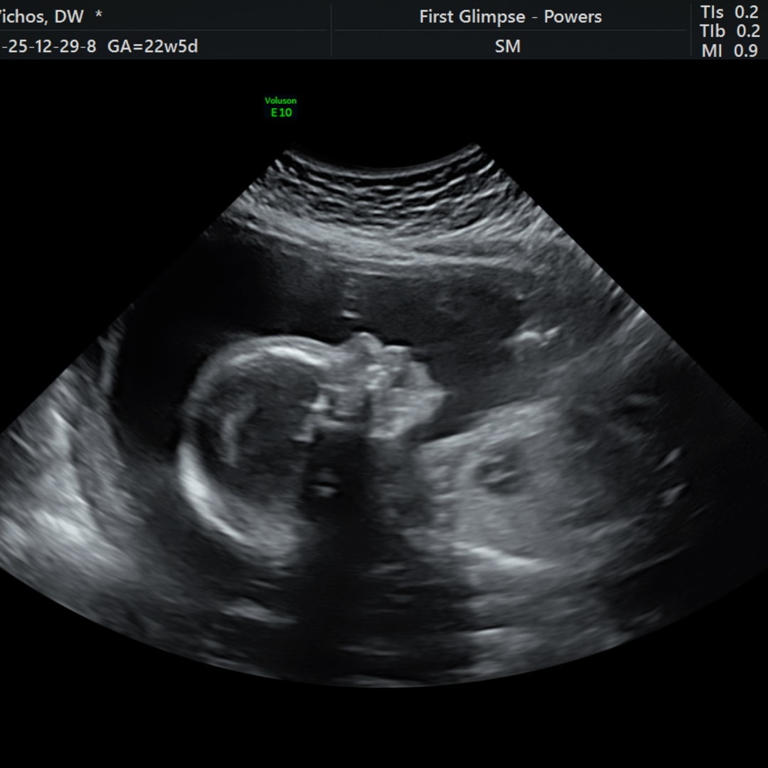 Photo shared by Delissia for their Babylist baby registry.