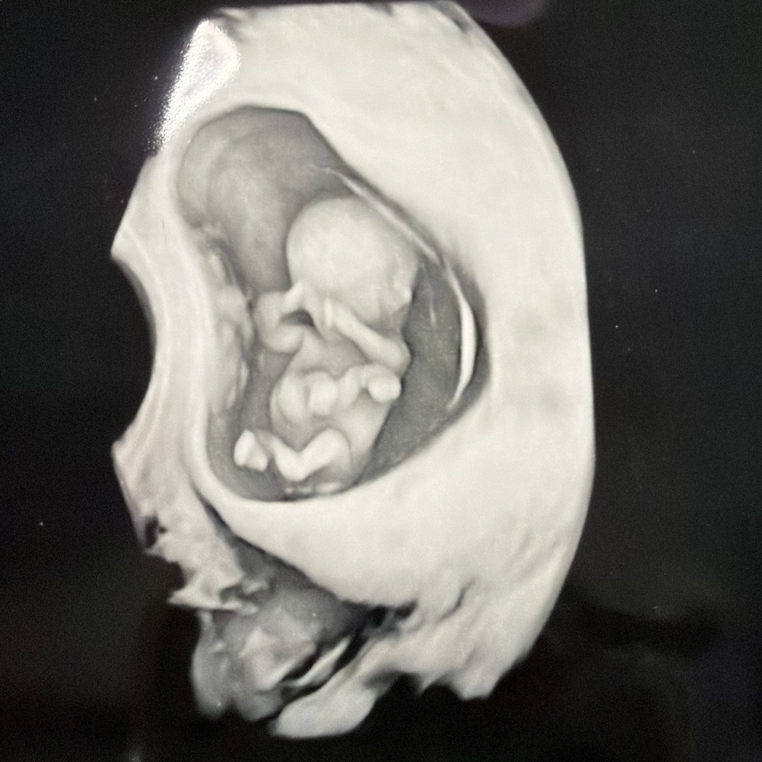 Photo shared by Lilly for their Babylist baby registry.