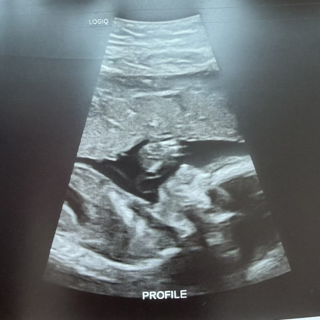 Photo shared by Autumn for their Babylist baby registry.