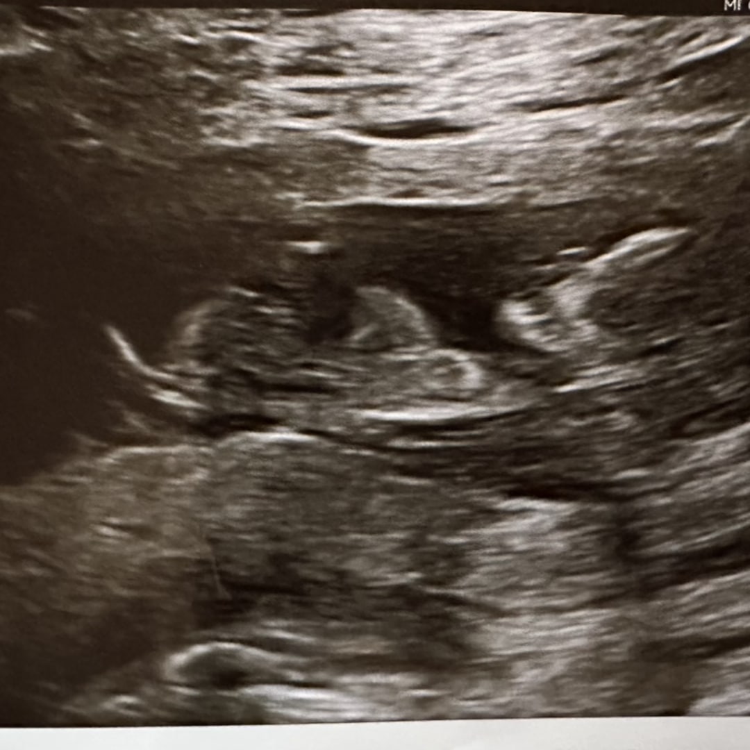 Photo shared by Reagan for their Babylist baby registry.