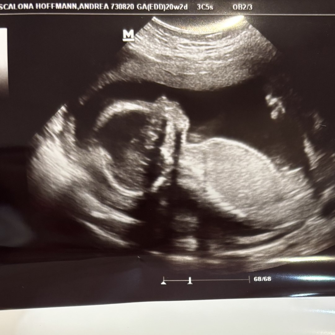 Photo shared by Andrea for their Babylist baby registry.