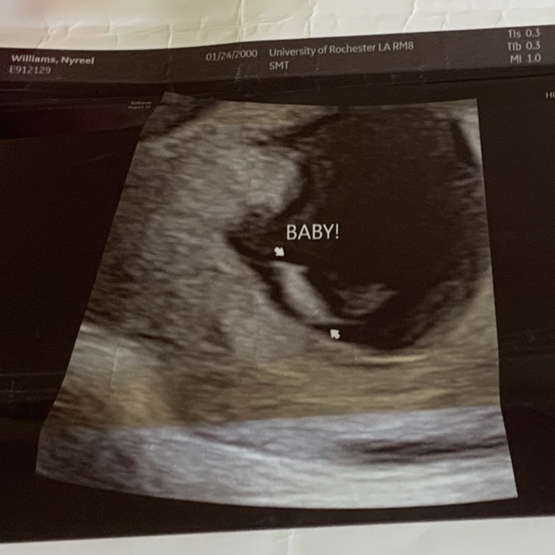 Photo shared by Nyree for their Babylist baby registry.