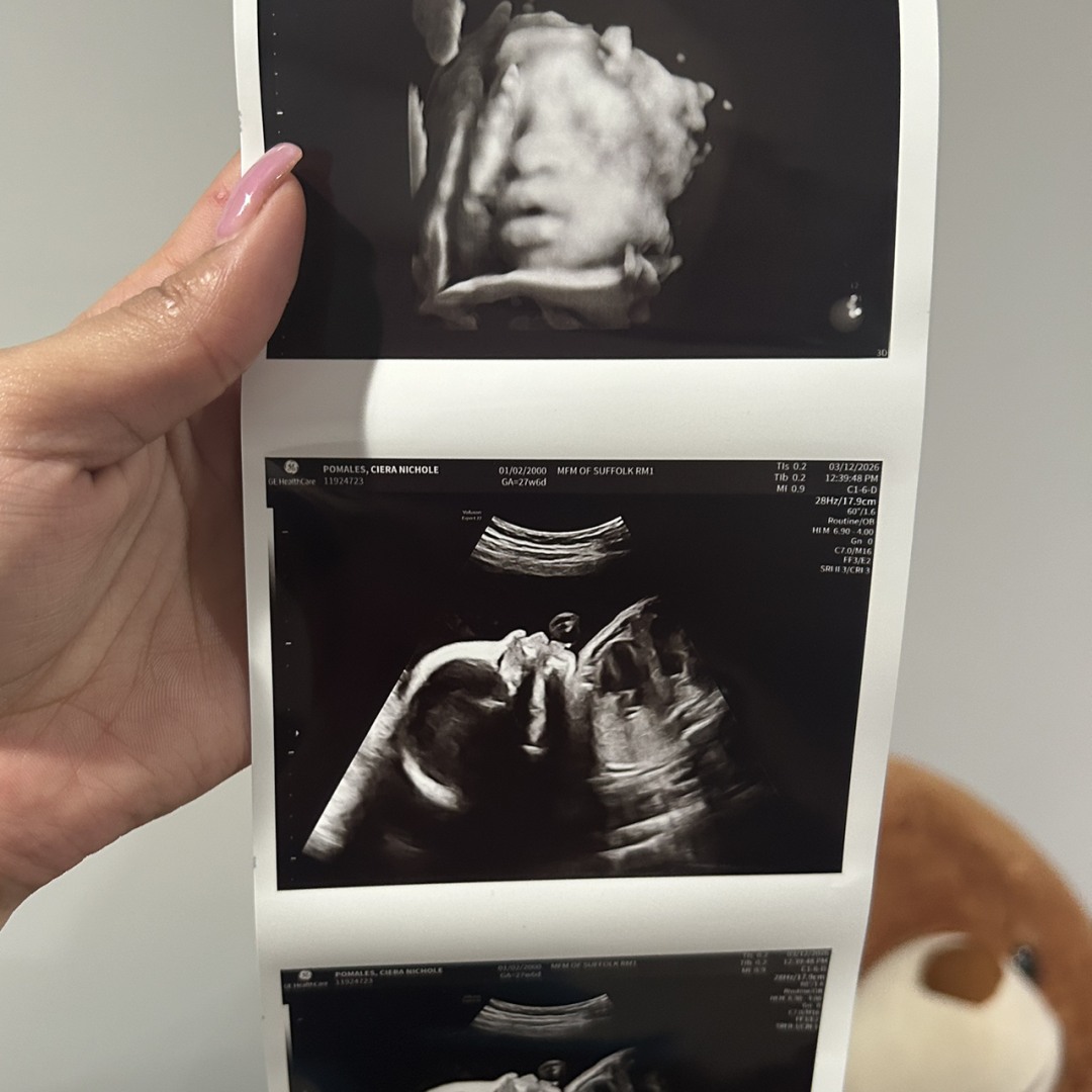 Photo shared by Ciera for their Babylist baby registry.