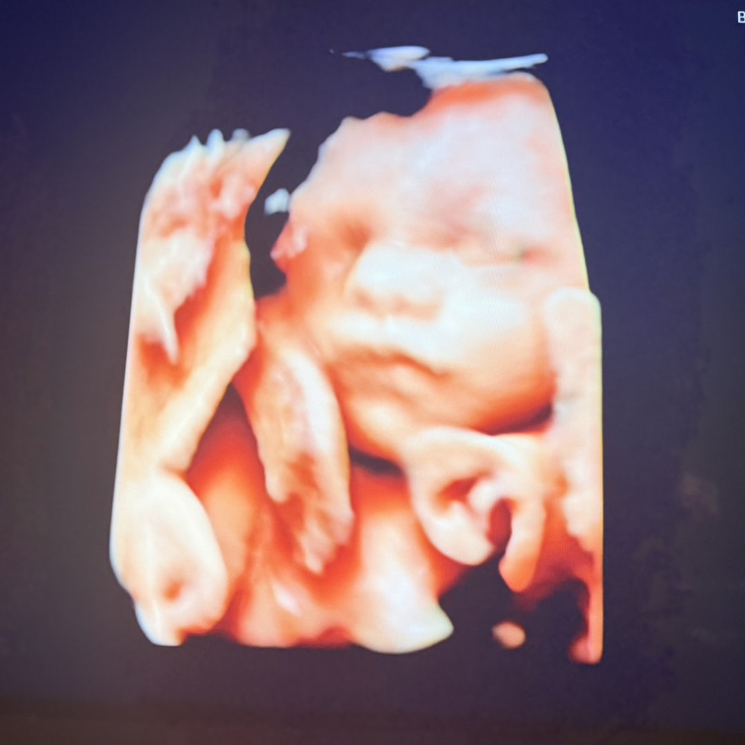 Photo shared by Arriana for their Babylist baby registry.