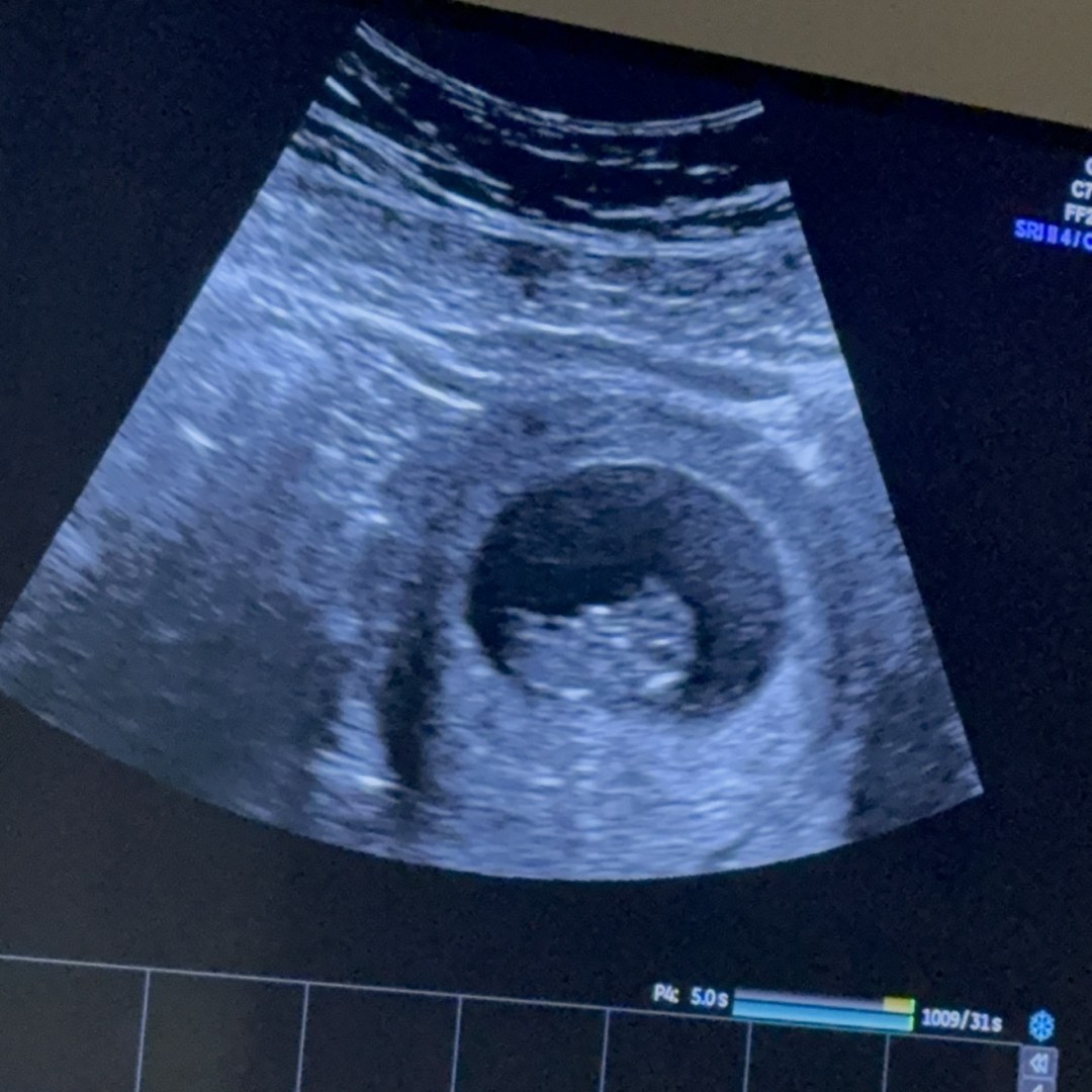 Photo shared by Daylyn for their Babylist baby registry.