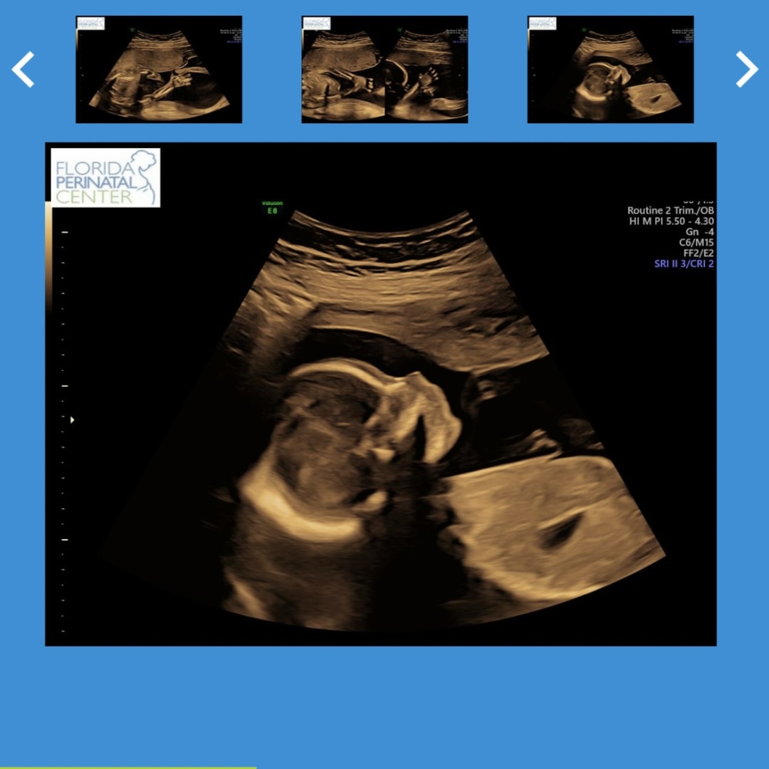Photo shared by Lauren for their Babylist baby registry.