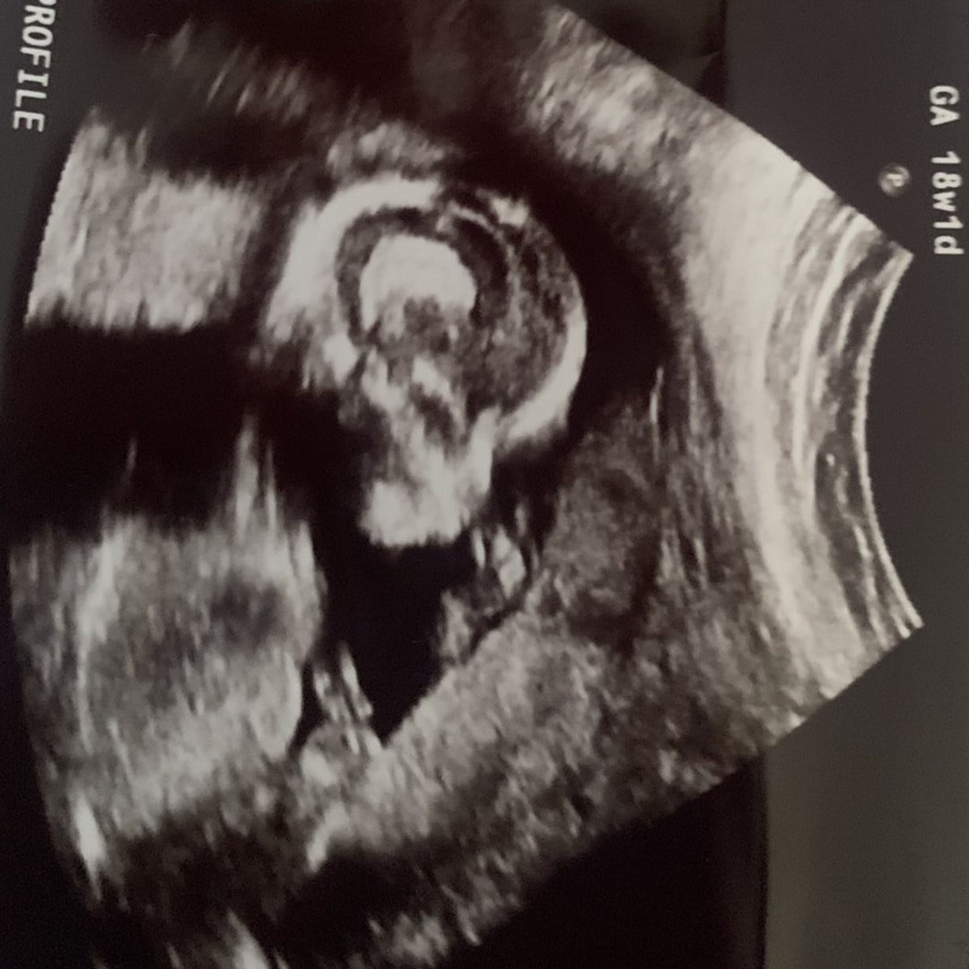 Photo shared by Cassadie for their Babylist baby registry.