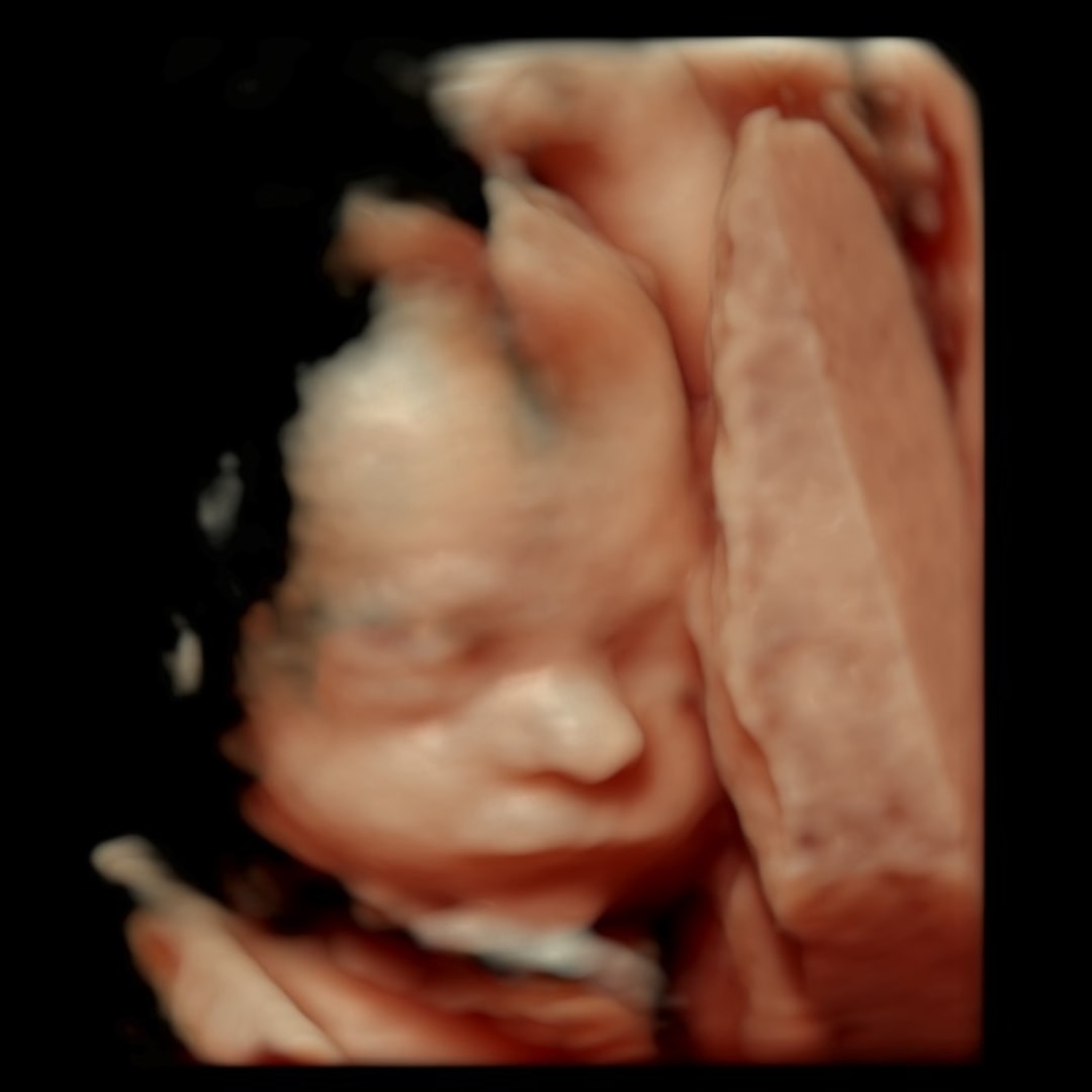 Photo shared by Gabby for their Babylist baby registry.