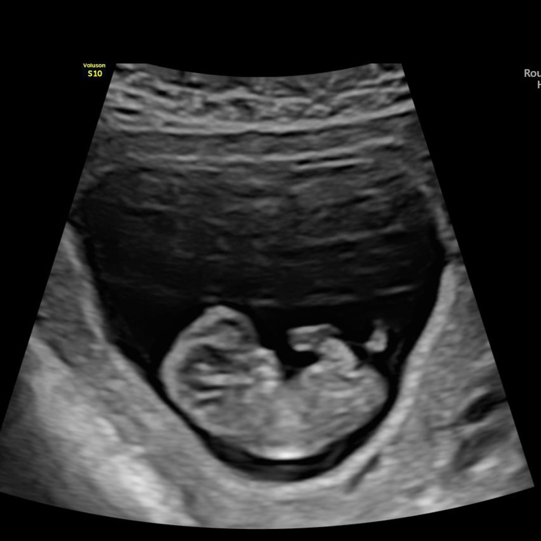 Photo shared by Carsun for their Babylist baby registry.
