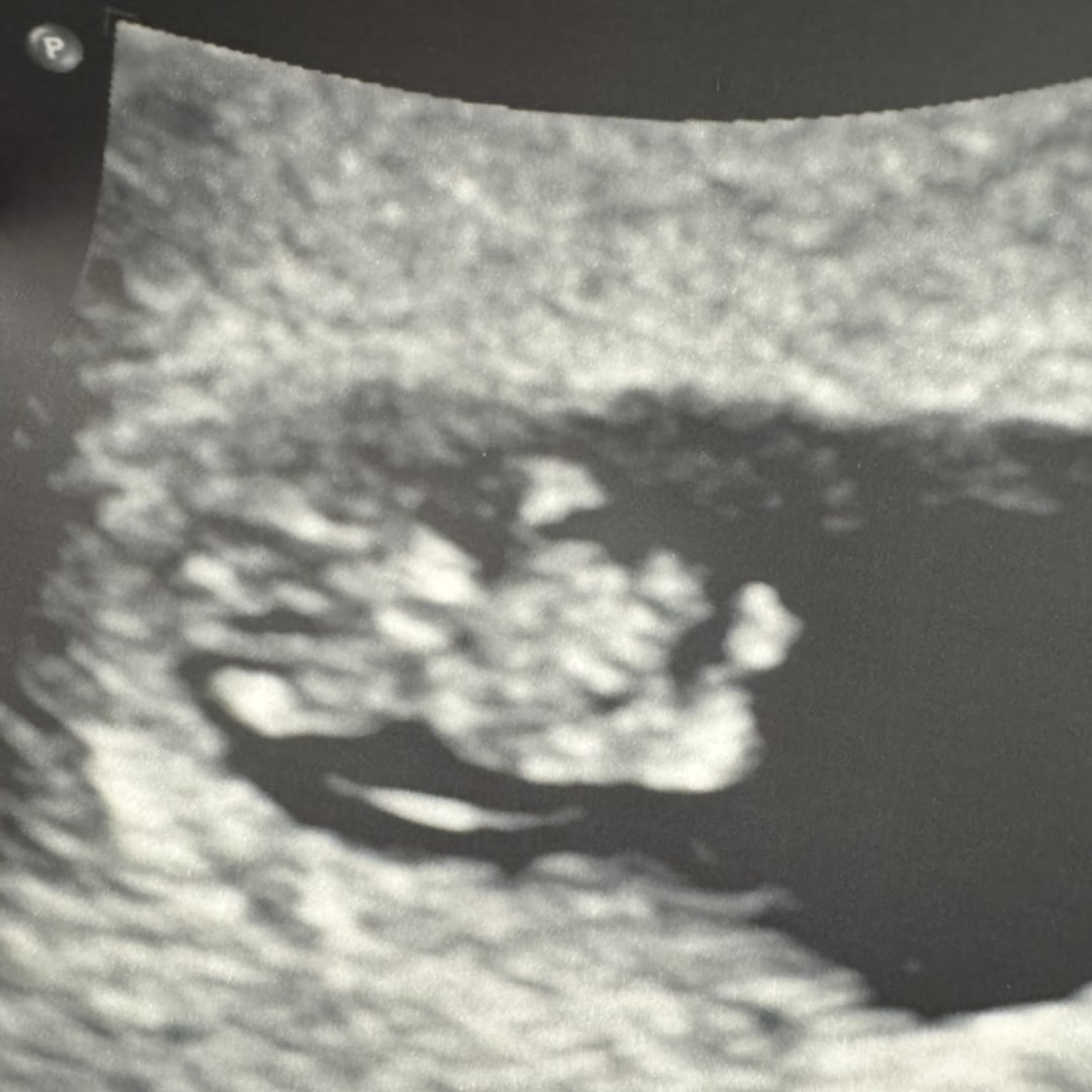 Photo shared by Frankie for their Babylist baby registry.