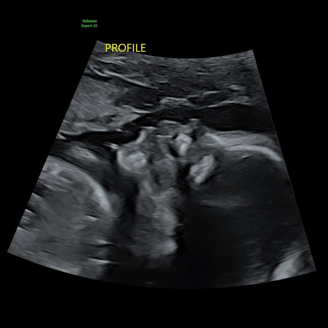 Photo shared by Jeanine for their Babylist baby registry.