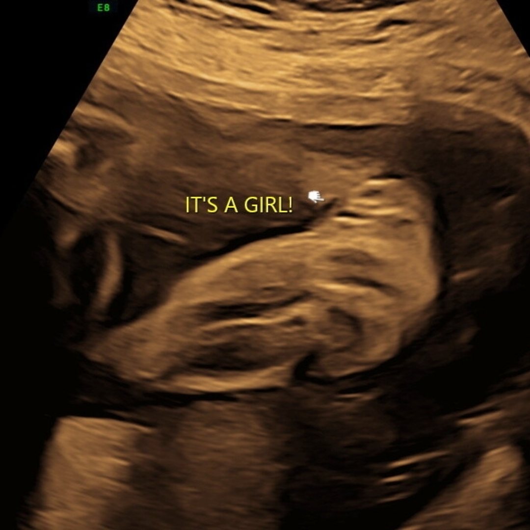 Photo shared by Breanna for their Babylist baby registry.