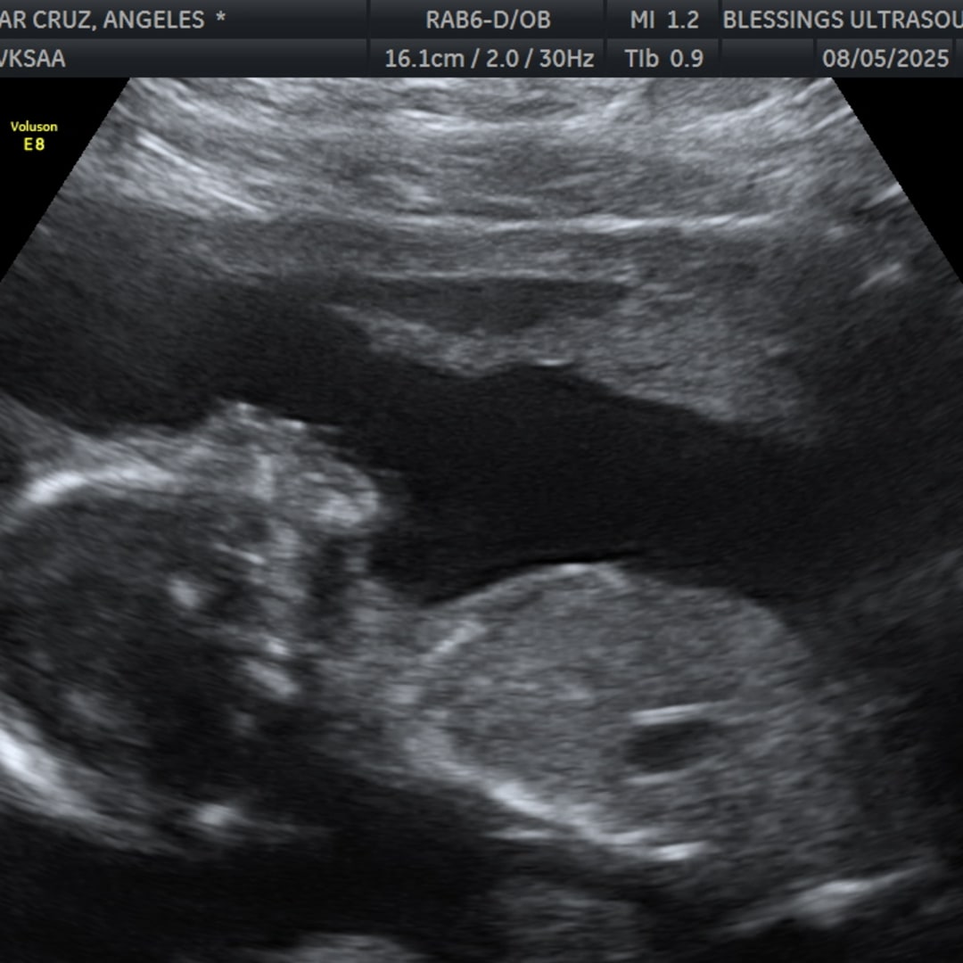 Photo shared by Angeles for their Babylist baby registry.
