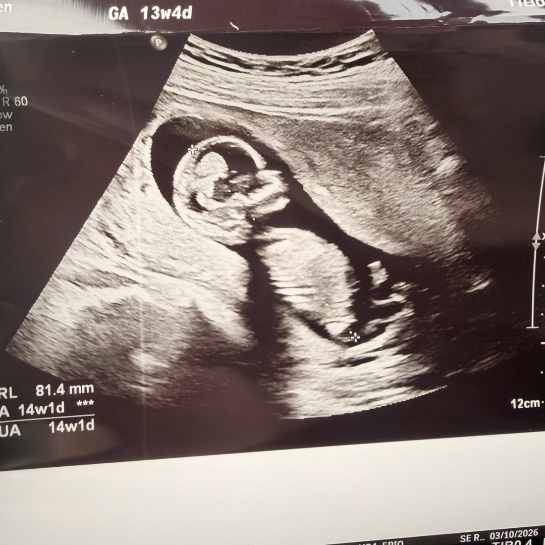 Photo shared by Amie for their Babylist baby registry.