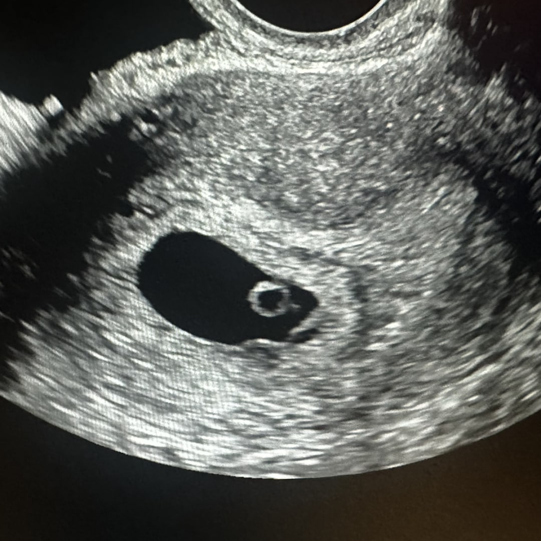 Photo shared by Isabella for their Babylist baby registry.