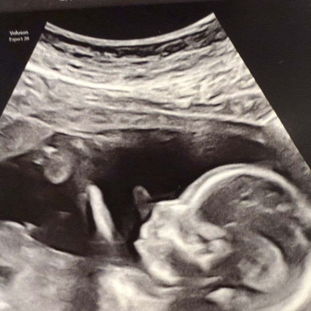 Photo shared by Alkesha for their Babylist baby registry.