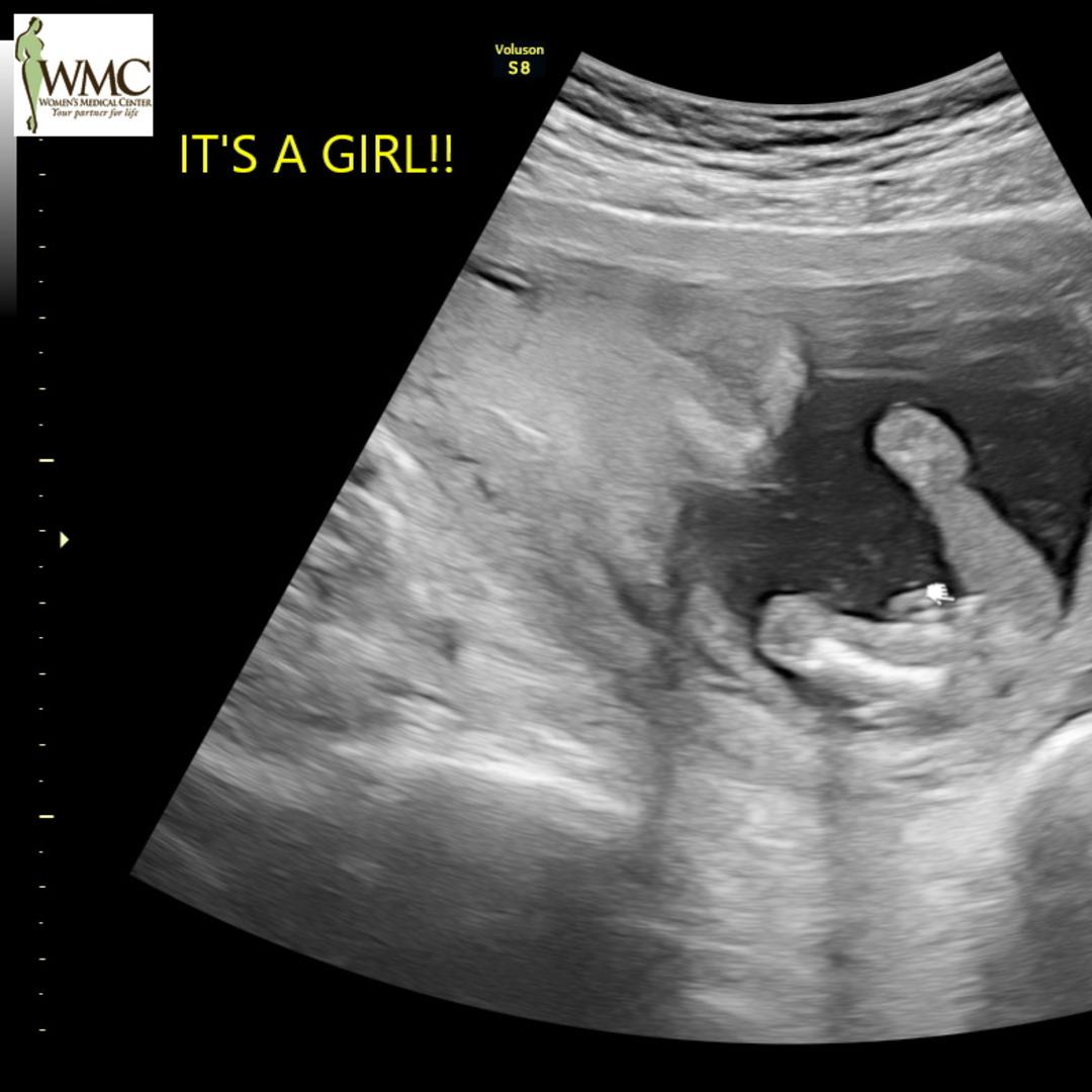 Photo shared by Callie for their Babylist baby registry.