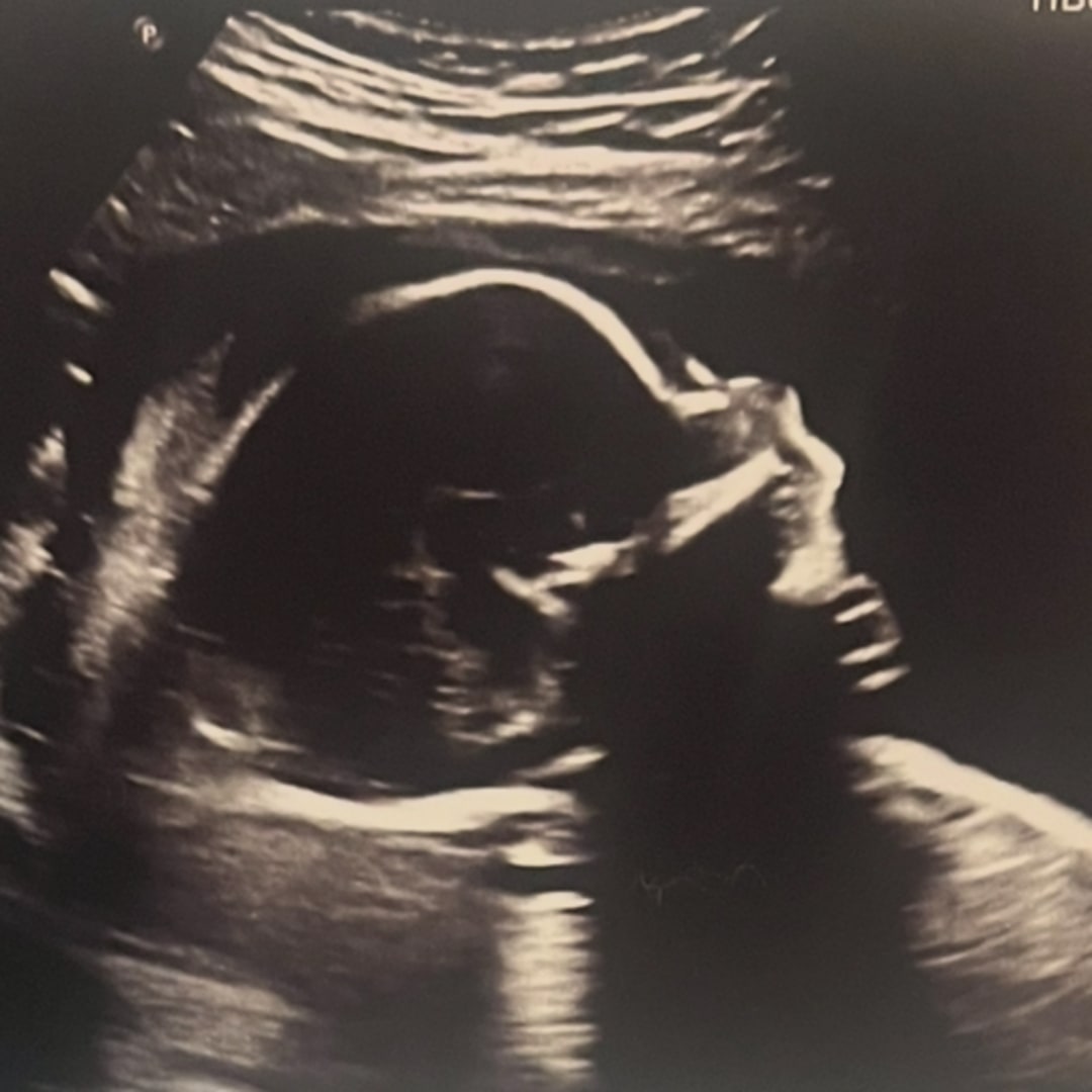 Photo shared by Emily for their Babylist baby registry.